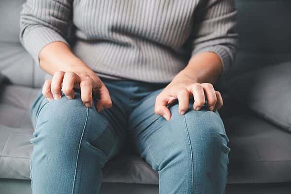 Brits with Common Skin Condition May Claim £194.60 Weekly from DWP